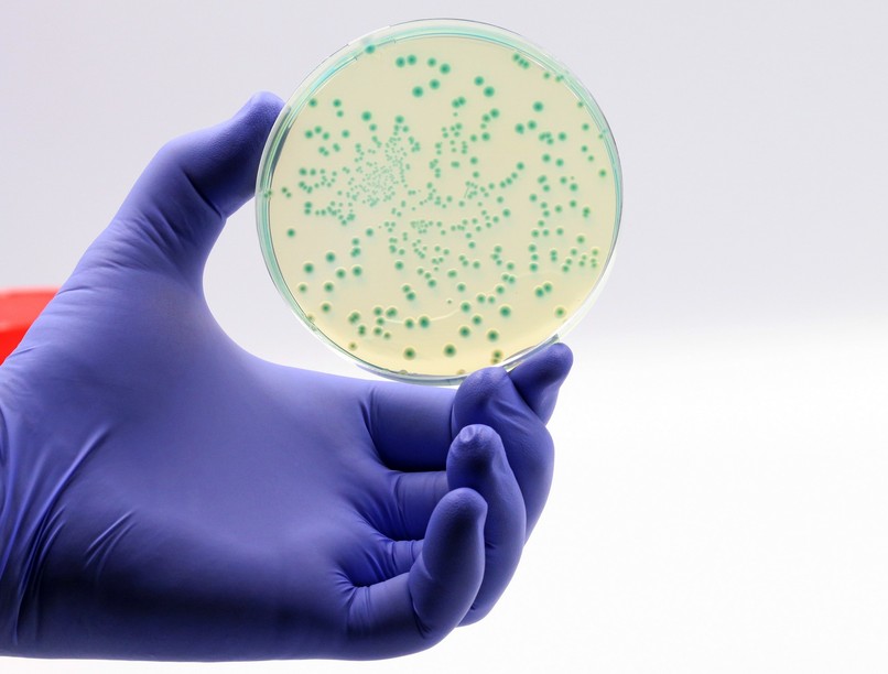 spanyolország szuperbaktérium halál