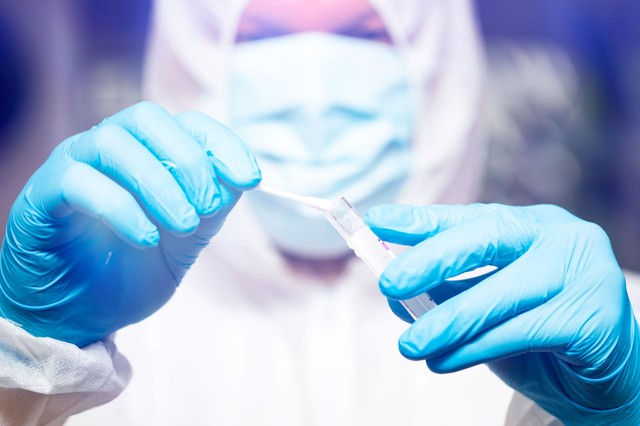 Hogyan zajlik egy COVID-19 vizsgálat?