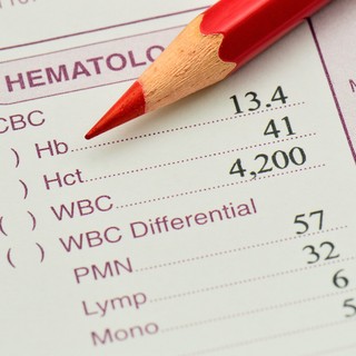 Mit jelent a hematokrit (Htc) érték a laborleleten? című cikk nyitóképe