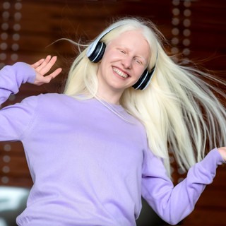 Albinizmus: tünetei, vizsgálata és kezelési lehetőségei című cikk nyitóképe