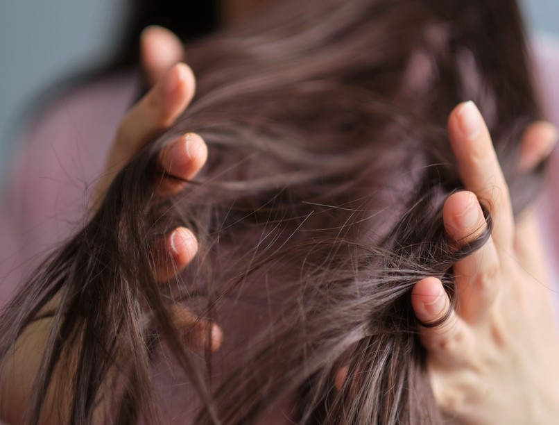 hajhagyma hajápolás hideg tél