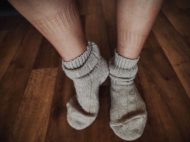 Ezért nem mindegy, milyen nyomot hagy a zokni a lábán!