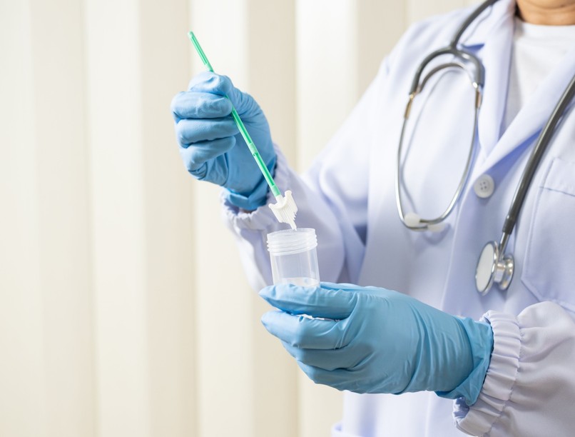 HPV rákszűrés, vizsgálat, méhnyakrák