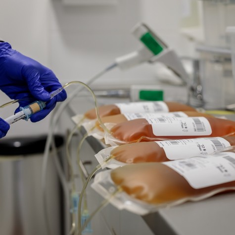 Ritka Betegségek Világnapja: ezért létfontosságú a plazmaadás emberek milliói számára című cikk nyitóképe