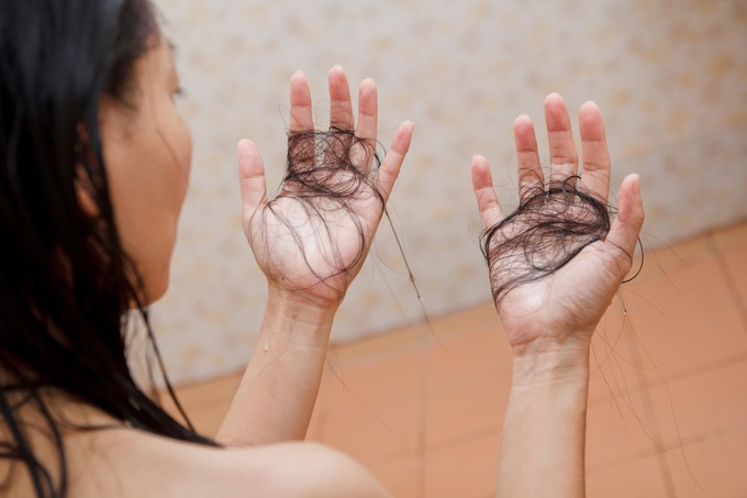 Ezekkel a természetes haj olajokkal megnyerheti a hajhullás elleni csatát című cikk nyitóképe