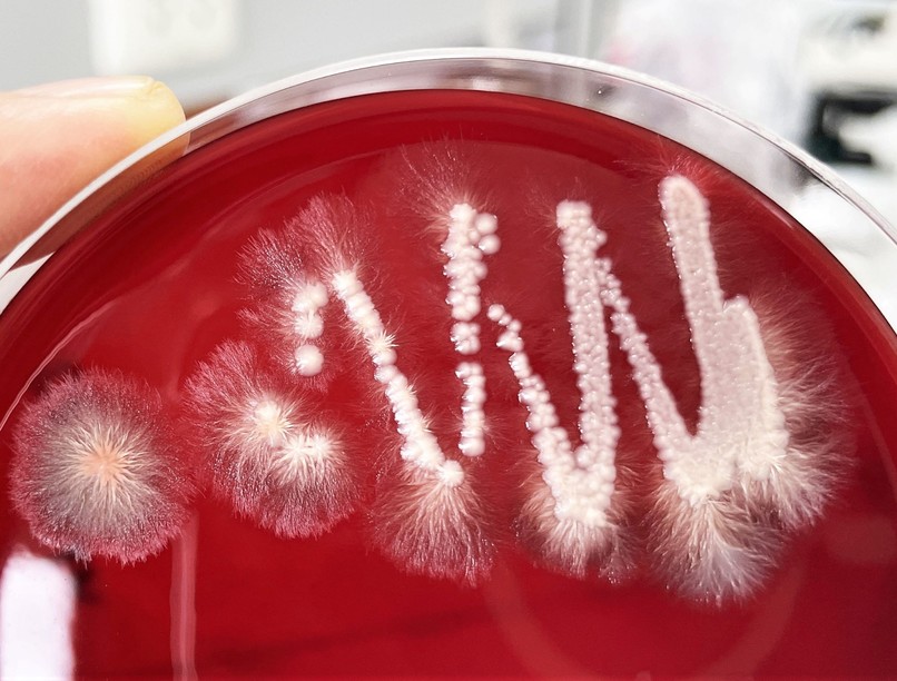 candida, Candida albicans, élesztőgomba, Candida-diéta, fertőzés