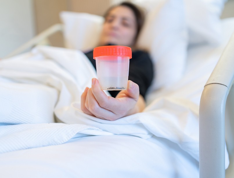 vesekő, ellen diéta, étkezés