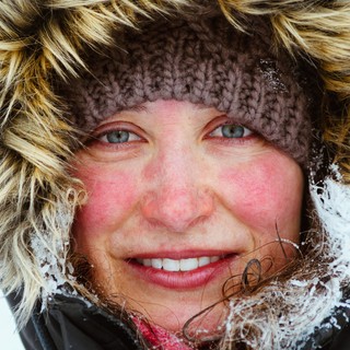 Miért pirosodik ki az arcunk, amikor melegünk van vagy fázunk? című cikk nyitóképe