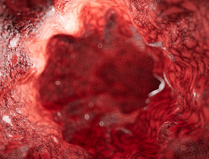 kapillaroszkópia mikrocirkuláció vizsgálata leírás