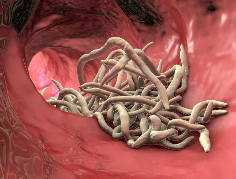 parazita bélféreg jele bélben gyulladás tünet