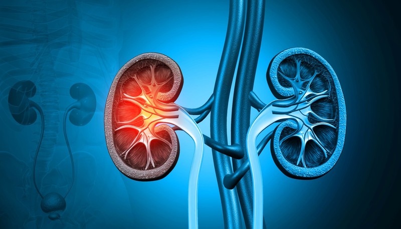 Kezeletlen vesebetegség: ilyen végzetes következményei is lehetnek