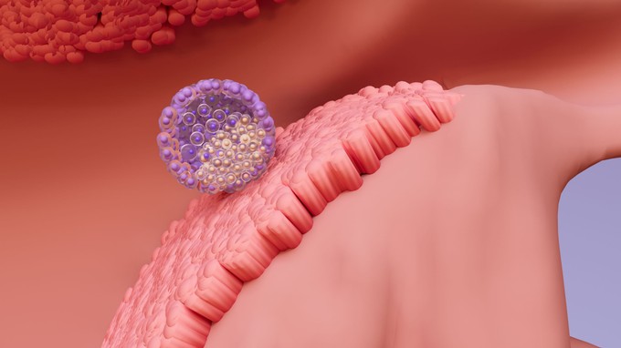 Elsőként rögzítették élőben videón, hogyan ágyazódik be egy emberi embrió című cikk nyitóképe