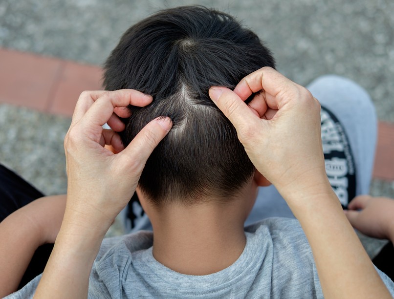 tetű, rühatka, élősködők, bélféreg