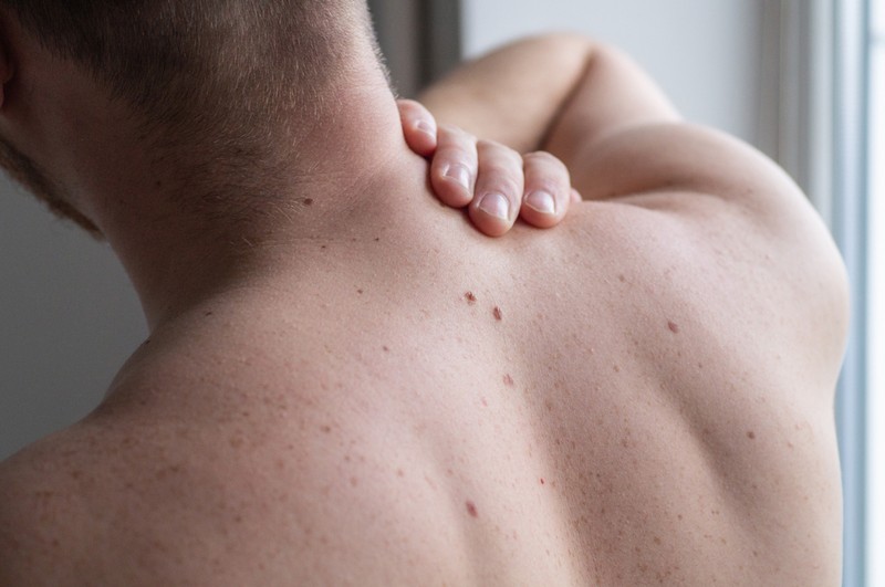 Óriási az igény az ingyenes SOTE digitális bőrdiagnosztikájára