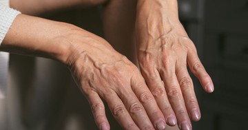 Így változnak a körmei az életkorral – mutatjuk, mi számít normálisnak