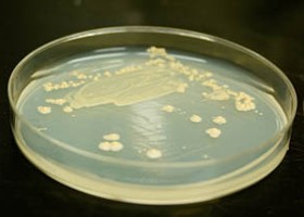 Botulizmus: tünetei, vizsgálata és kezelési lehetőségei