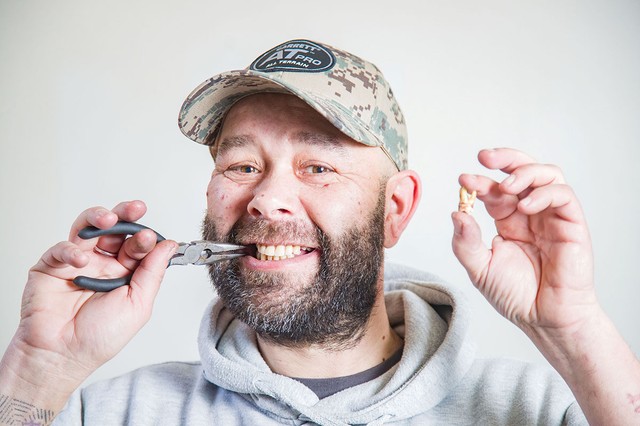 Hihetetlen: saját magának húzta, ki a fogát egy férfi, mert nem kapott időpontot a fogászatra