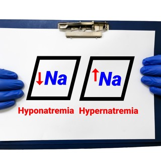 Mit jelent a nátrium érték a laborleleten? című cikk nyitóképe