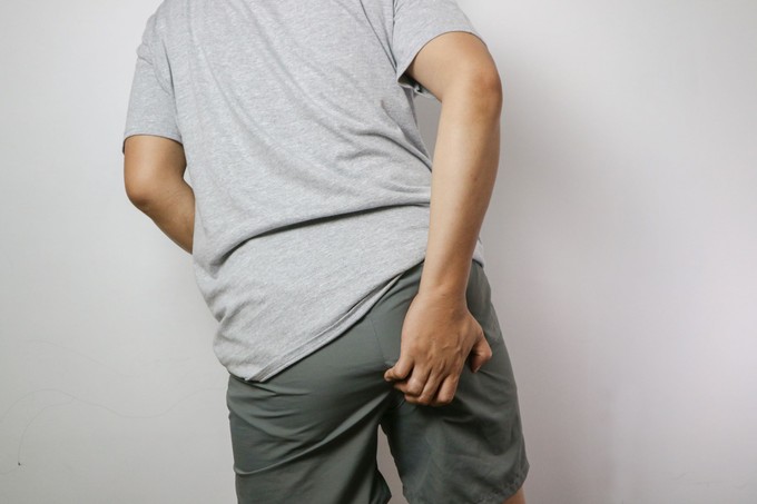 Kellemetlen, de érdemes beszélni róla: ezért viszkethet a hátsó fele című cikk nyitóképe